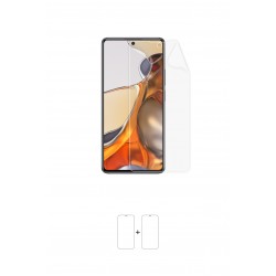 Xiaomi 11T Pro Ekran Koruyucu Film (Parlak Şeffaf Poliüretan Film (150 micron), Ön)