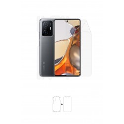 Xiaomi 11T Pro Ekran Koruyucu Film (Parlak Şeffaf Poliüretan Film (150 micron), Full Body)